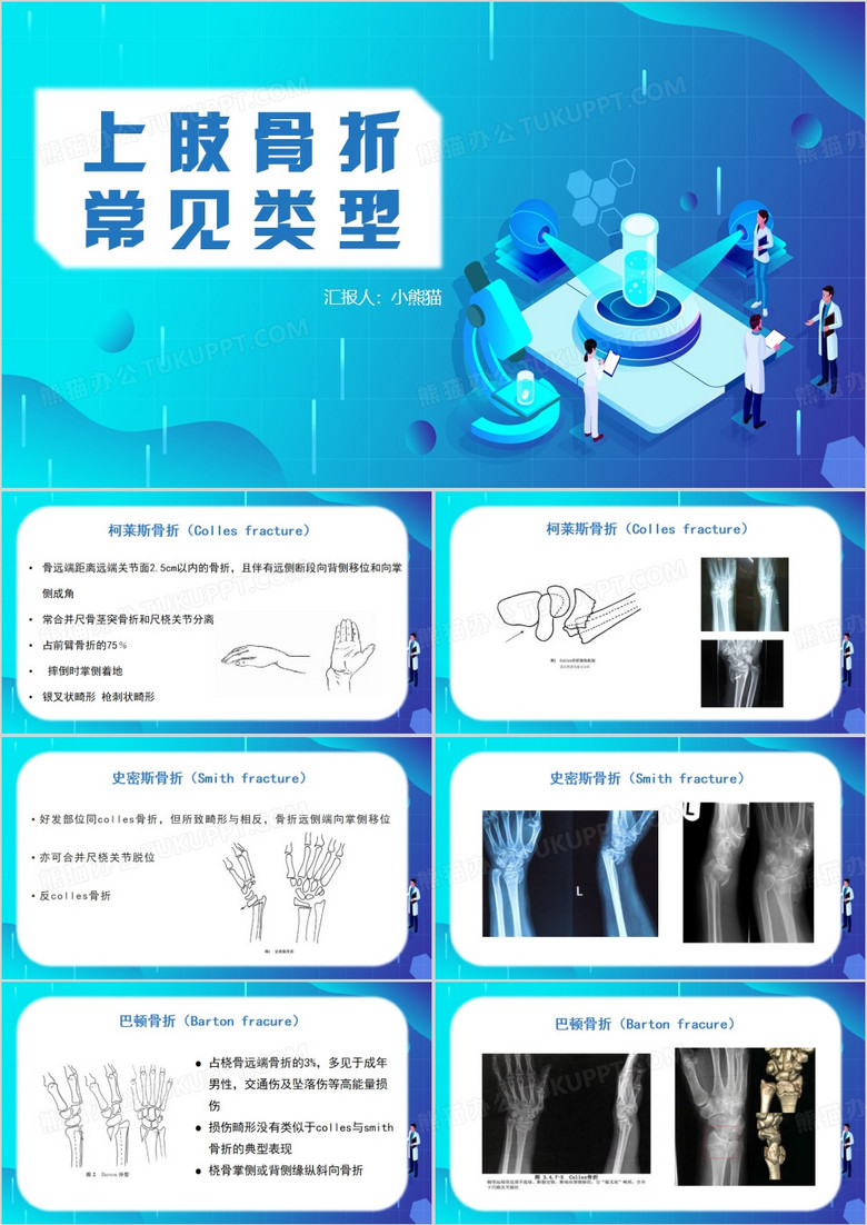上肢骨折常见类型蓝色PPT模板