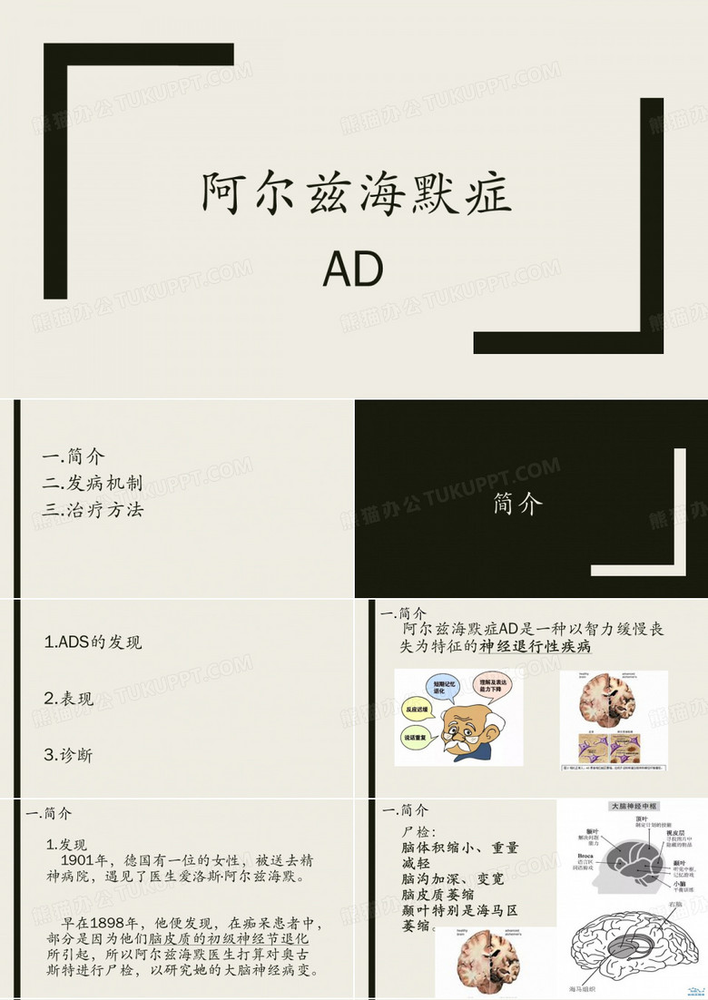 阿尔兹海默症