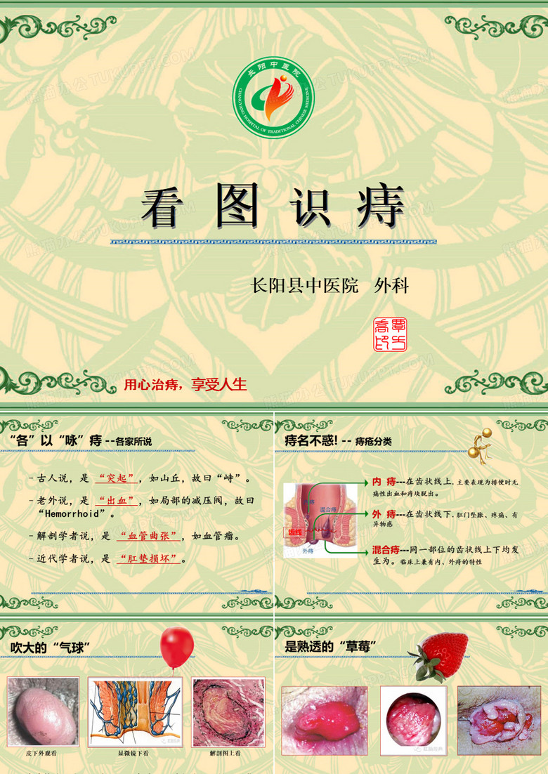 图说痔疮