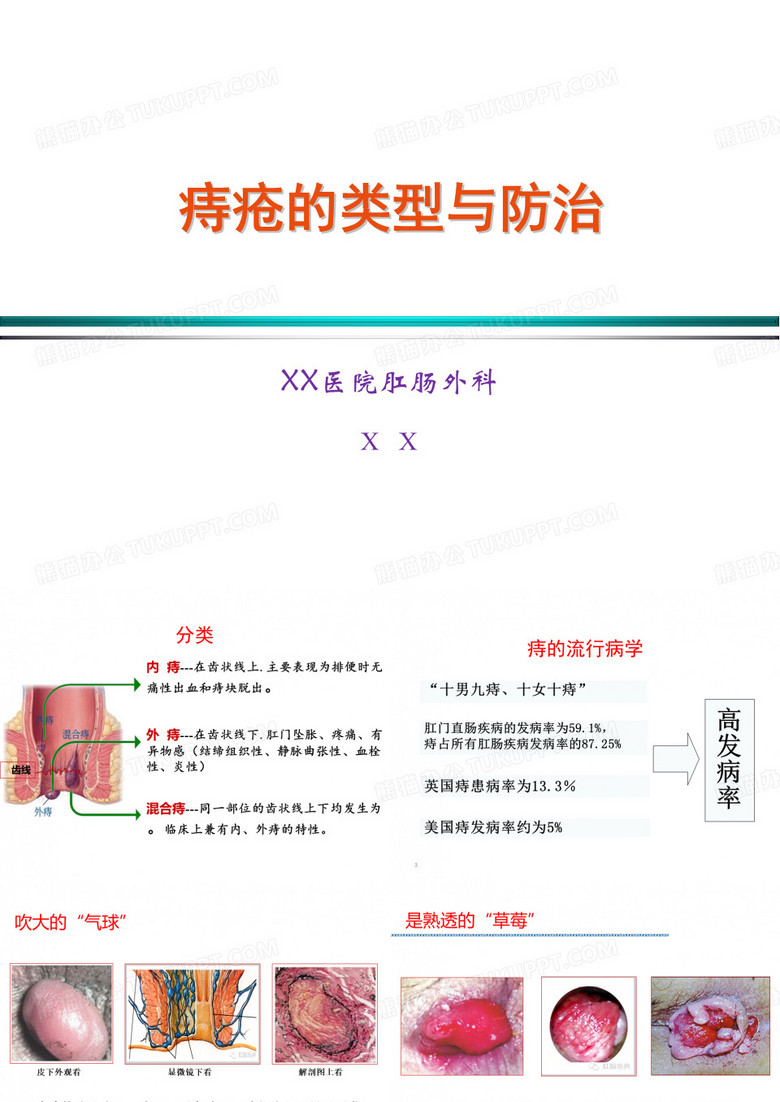 痔疮的分类与防治