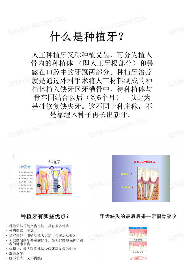 种植牙介绍