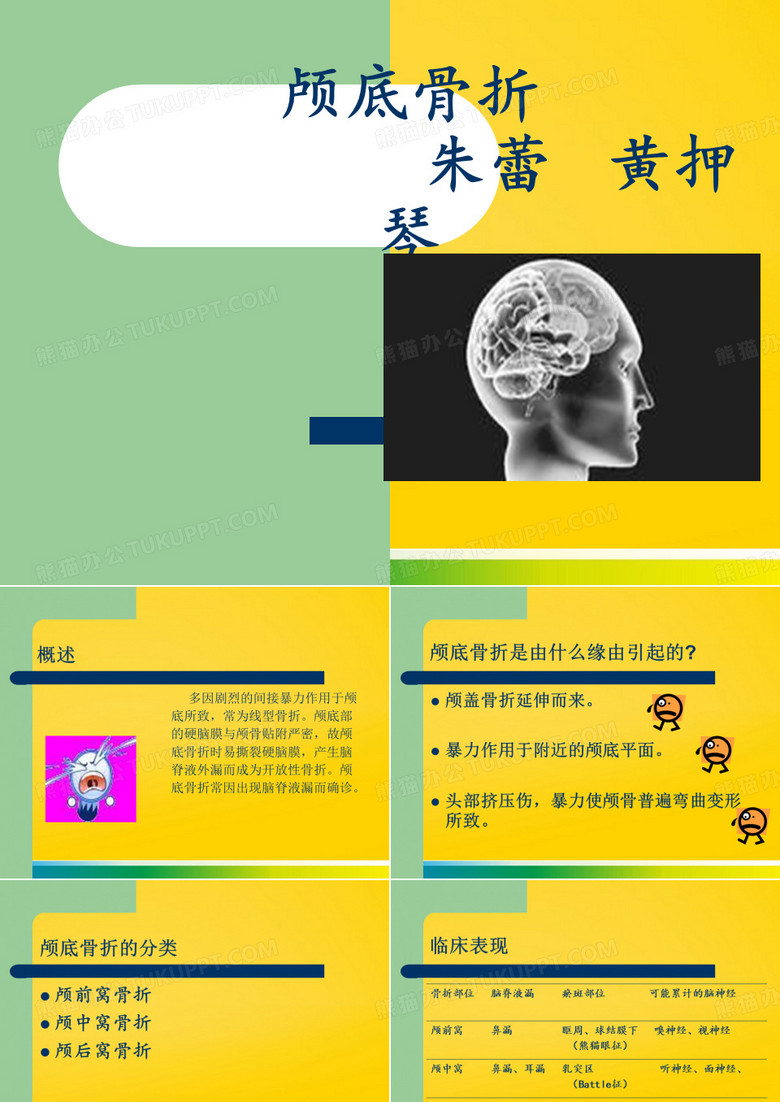 颅底骨折页PPT