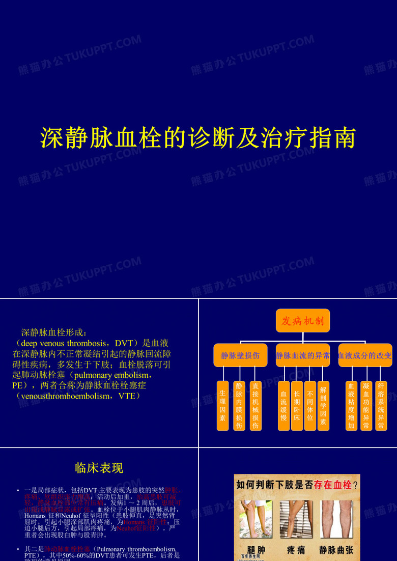 深静脉血栓