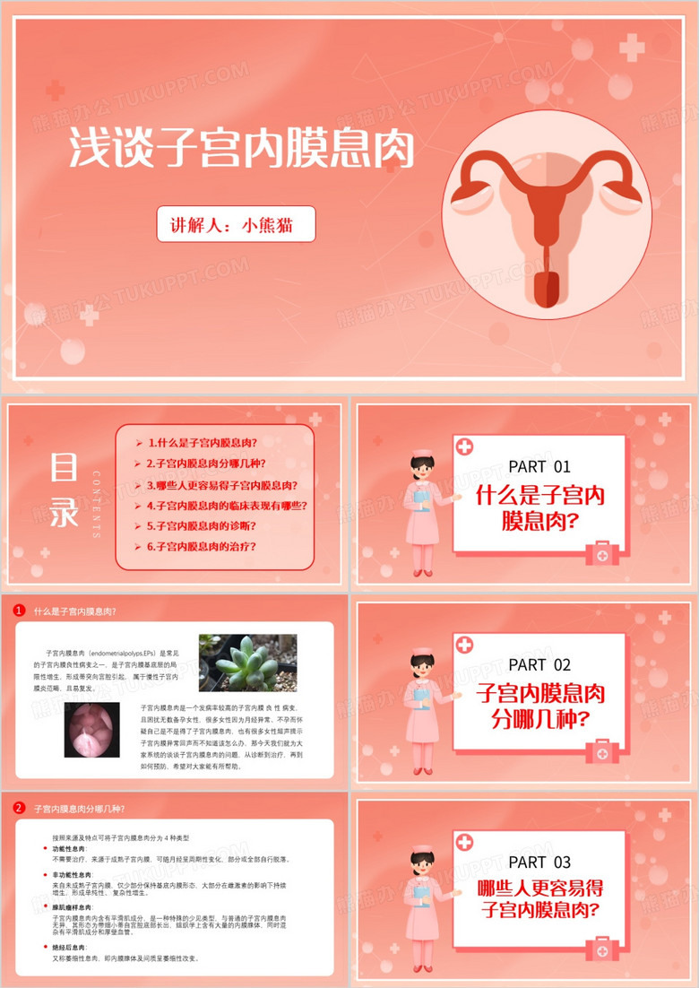 粉色简约护理查房浅谈子宫内膜息肉PPT模板