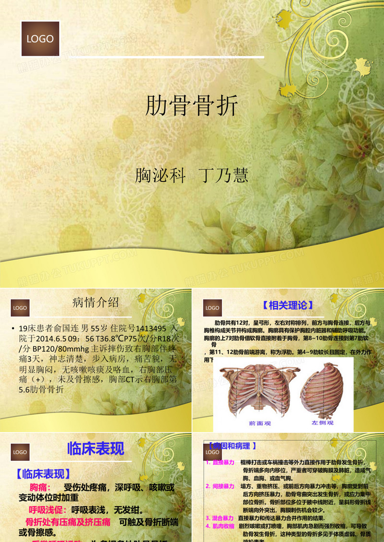 肋骨骨折