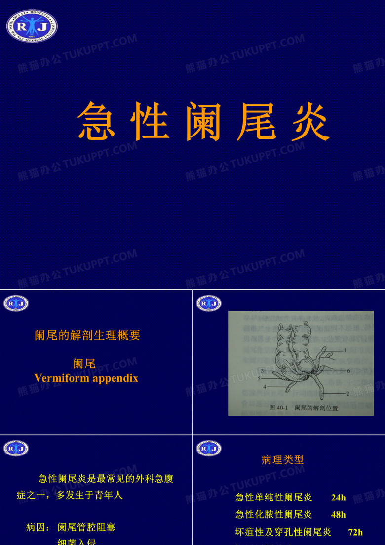 急性阑尾炎.