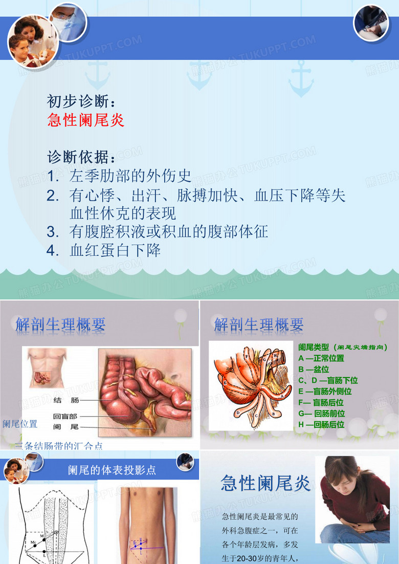 急性阑尾炎病例