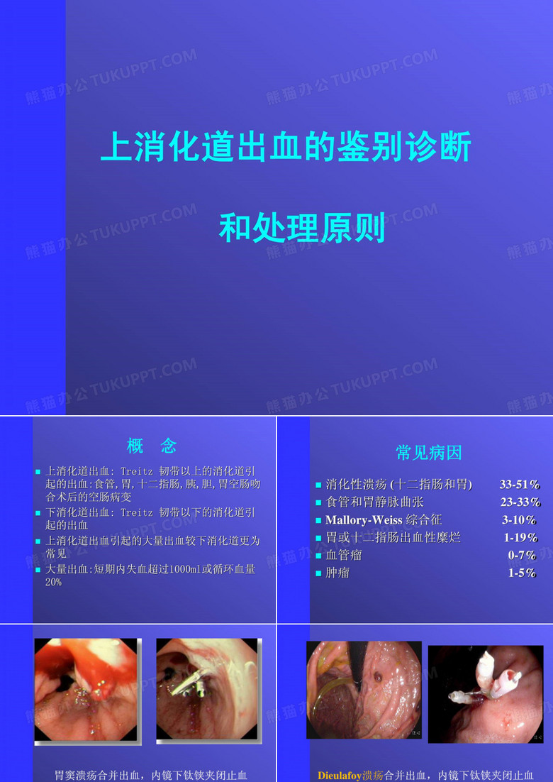 消化道出血