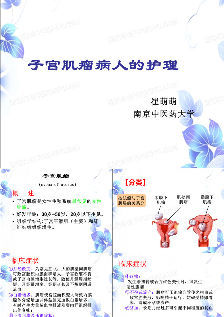 子宫肌瘤