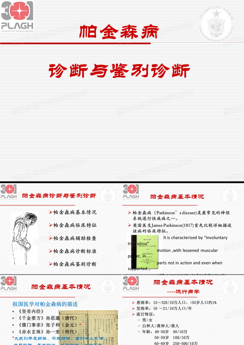 帕金森病