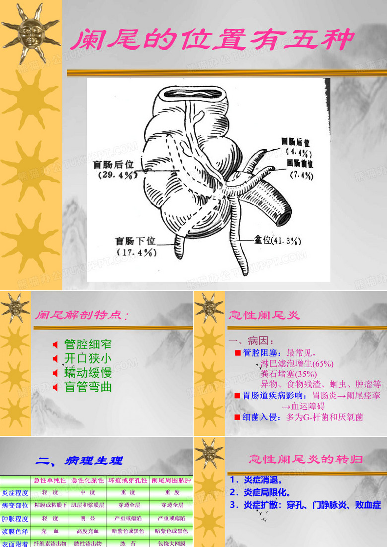 阑尾炎病人的护理本科授课PPT