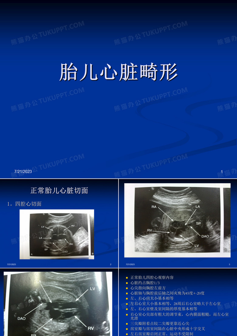 胎儿心脏畸形