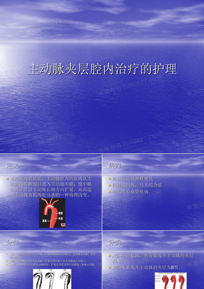 主动脉夹层