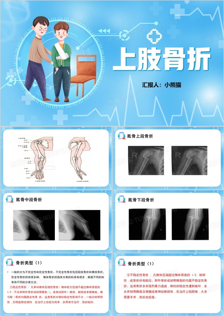 蓝色上肢骨折护理查房PPT模板