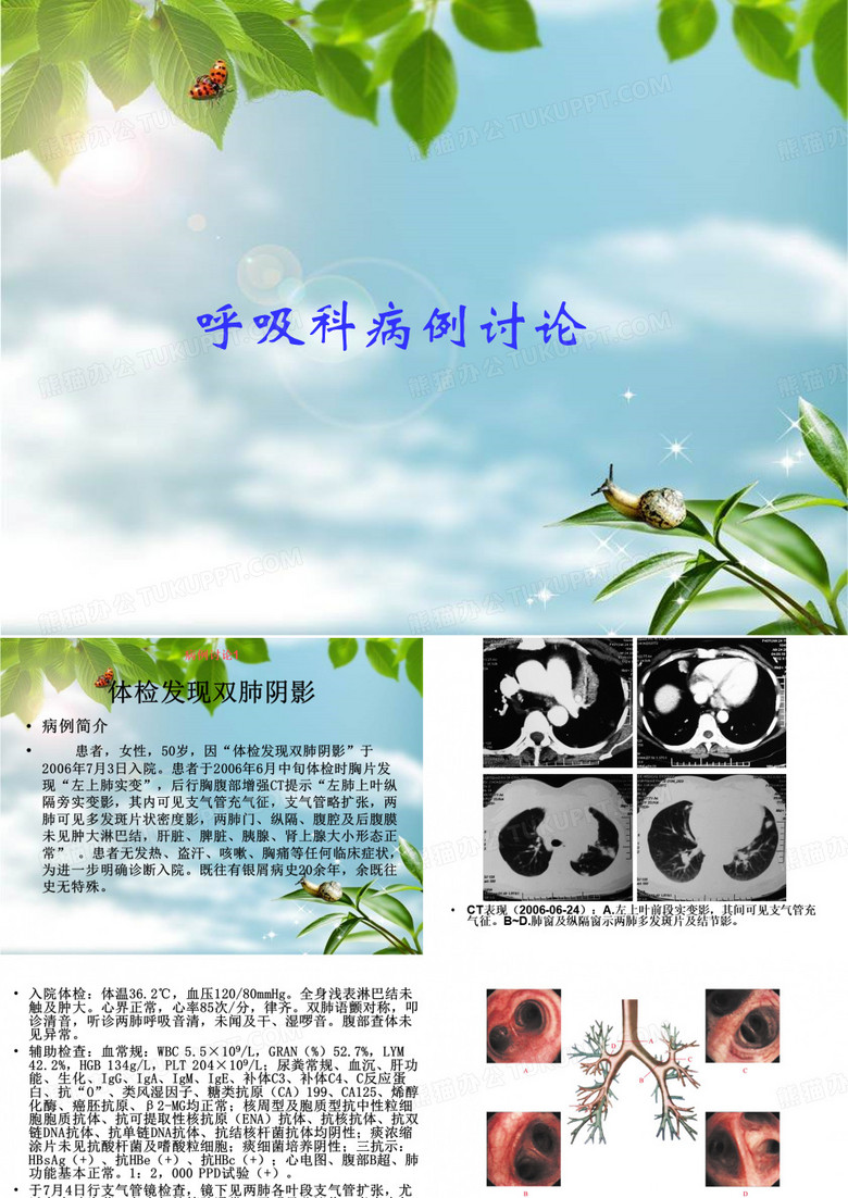 呼吸科病例讨论
