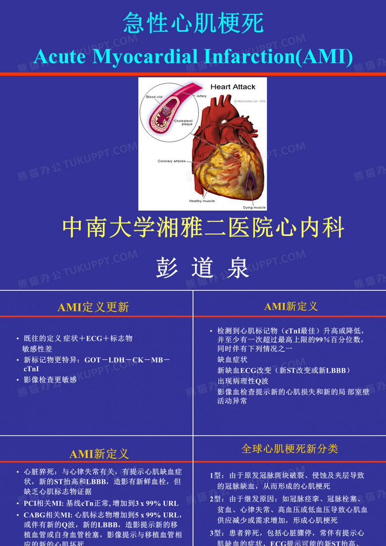 急性心肌梗死