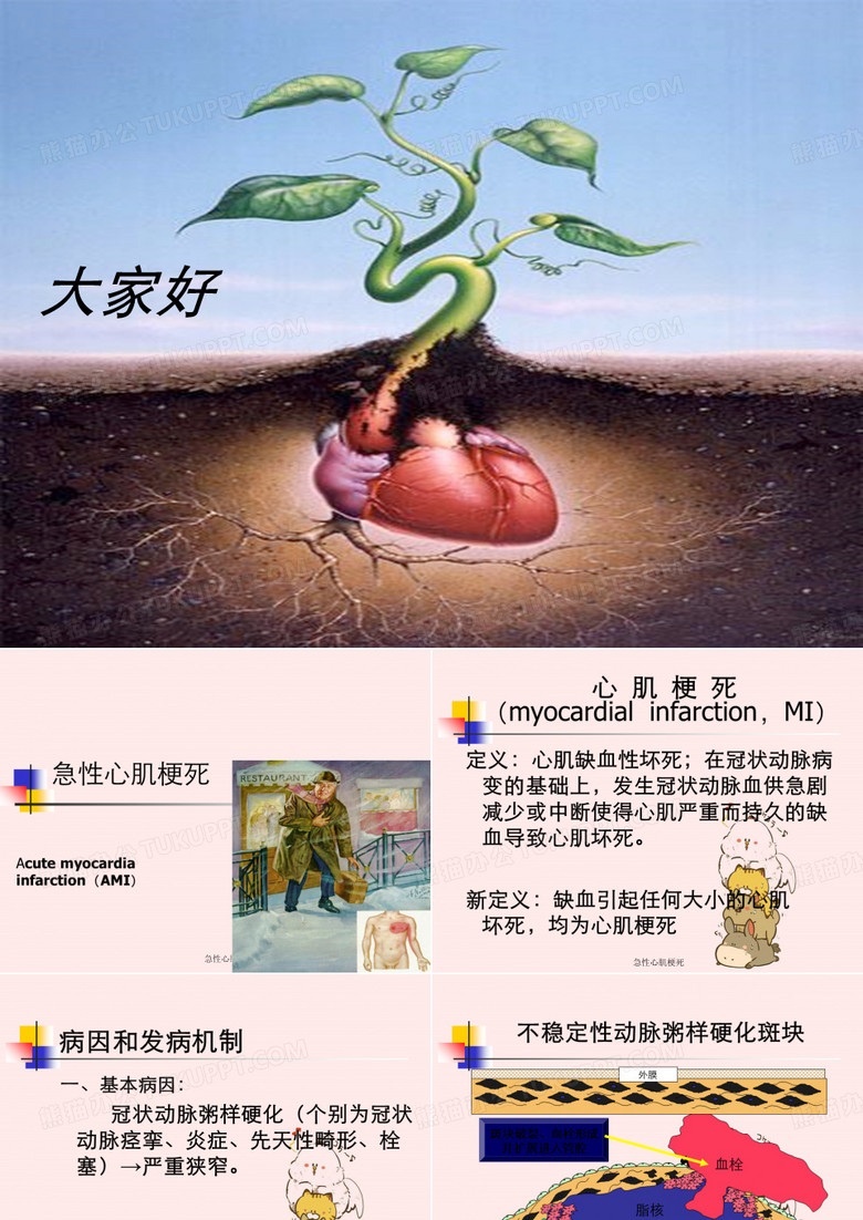 急性心肌梗死