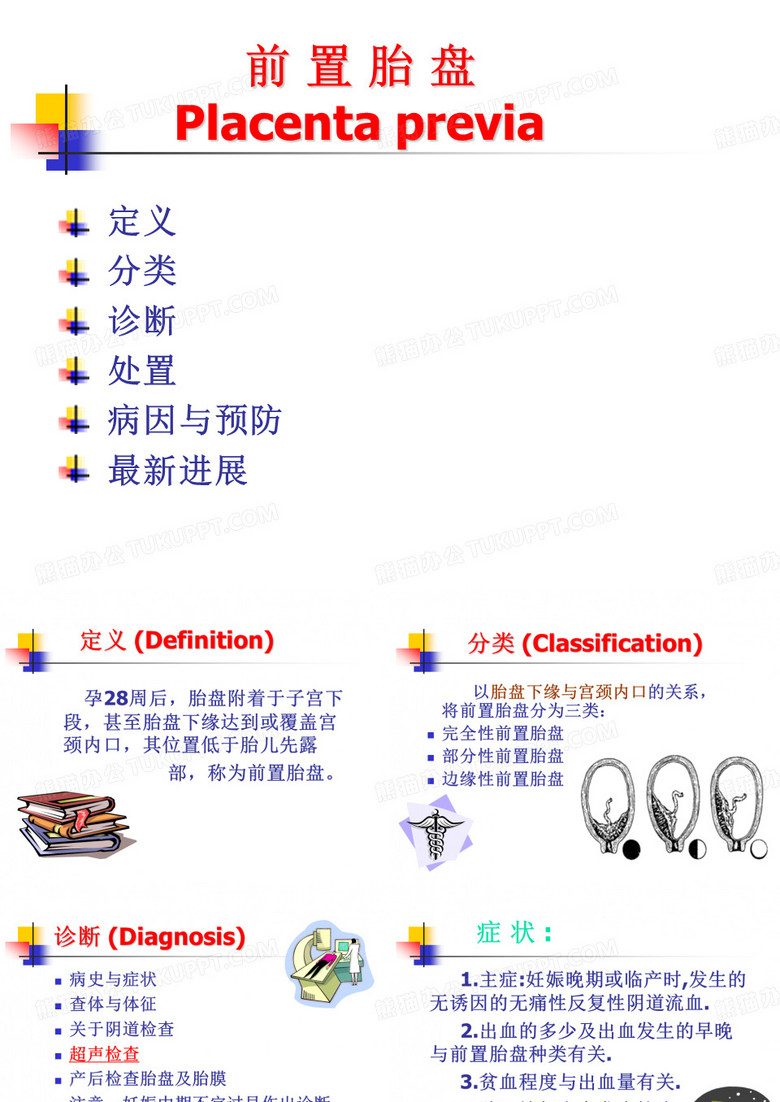 前置胎盘