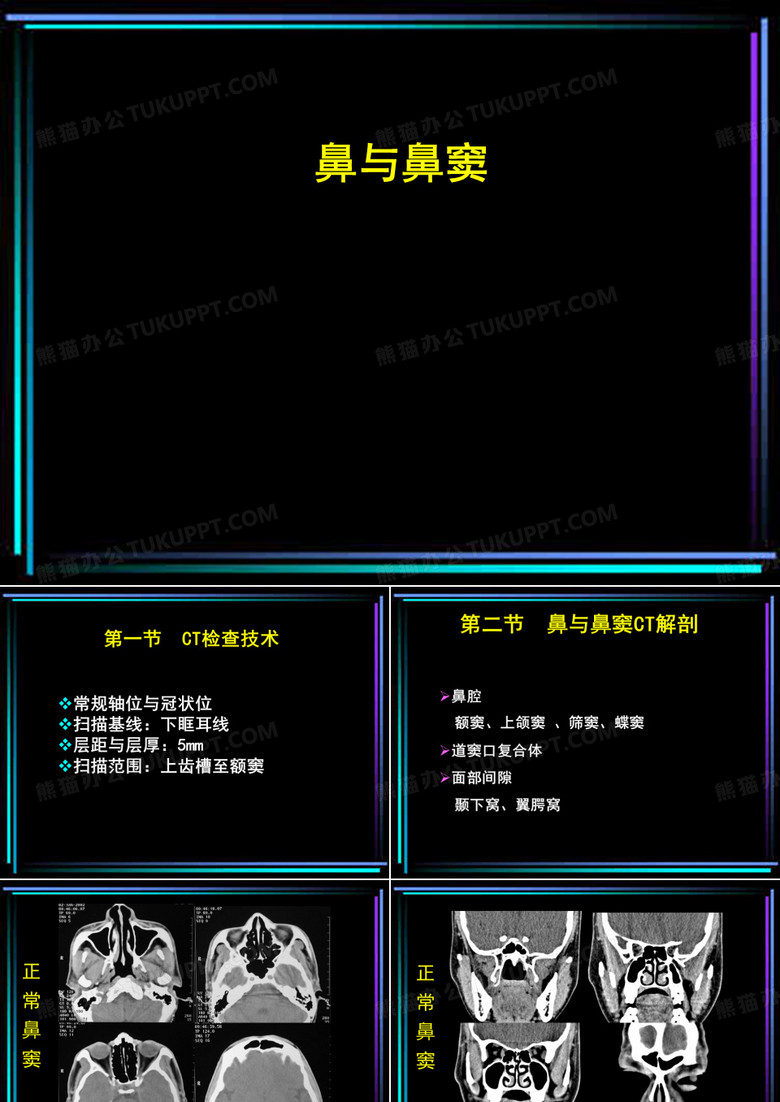 CT诊断学  鼻与鼻窦CT