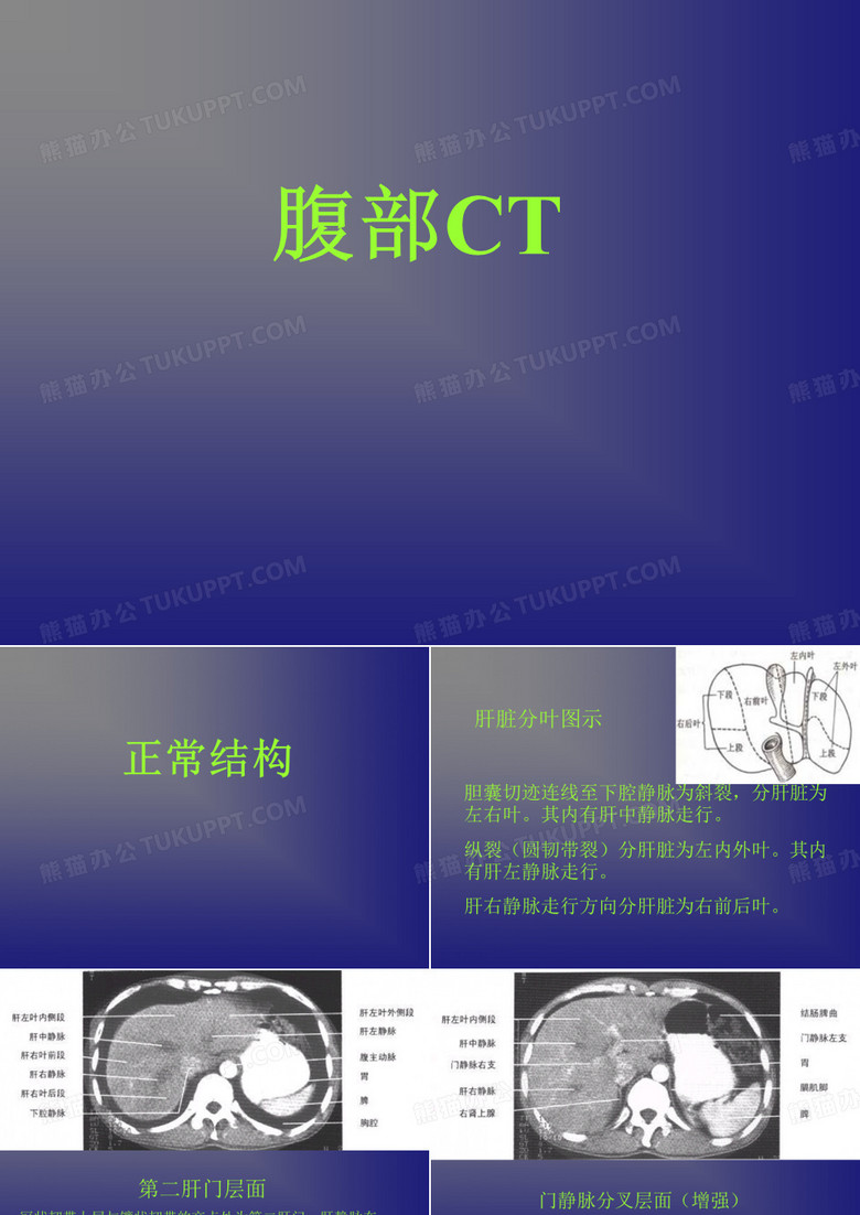 腹部CT