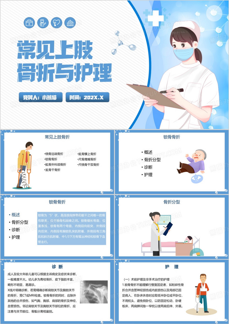 常见上肢骨折护理查房PPT模板