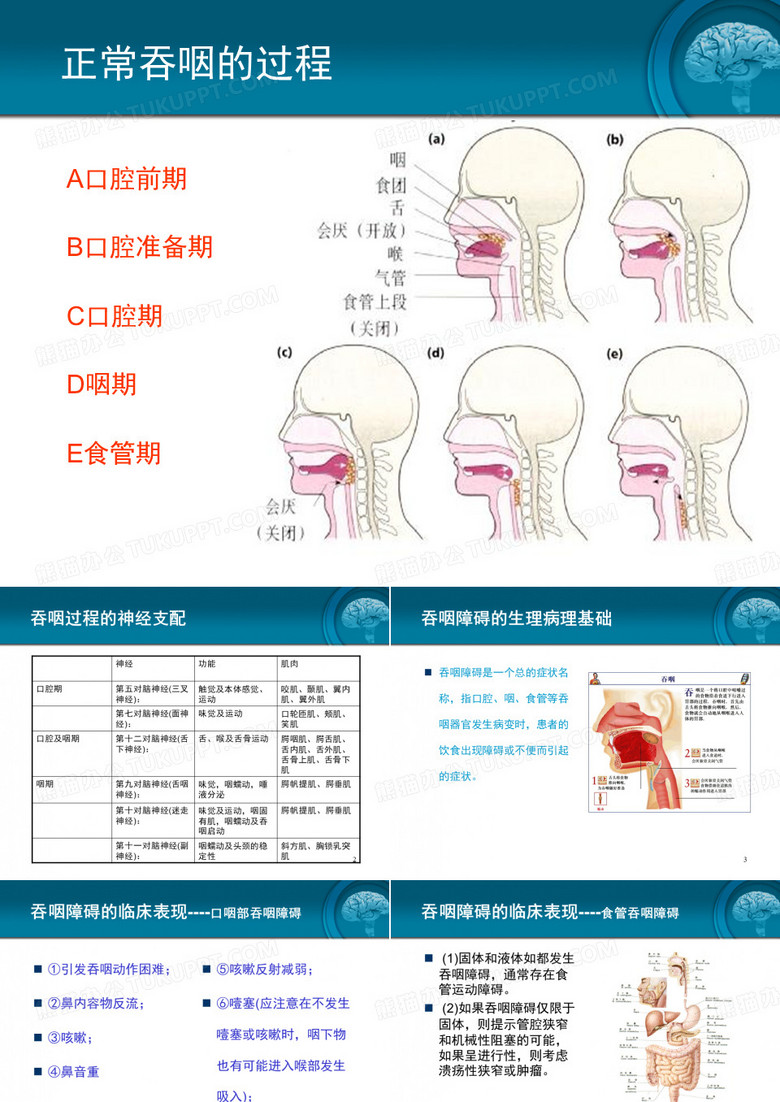 脑卒中吞咽障碍