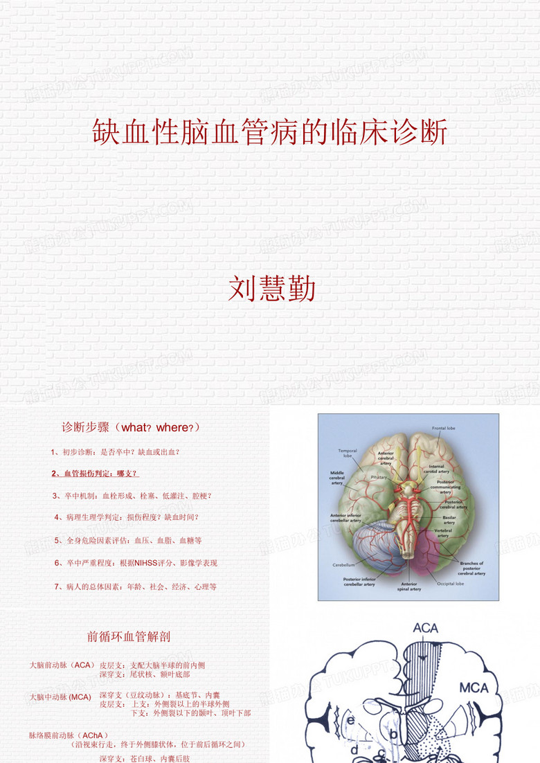 缺血性脑卒中的诊断