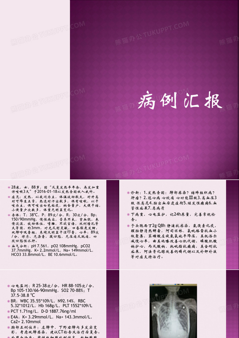 病例汇报