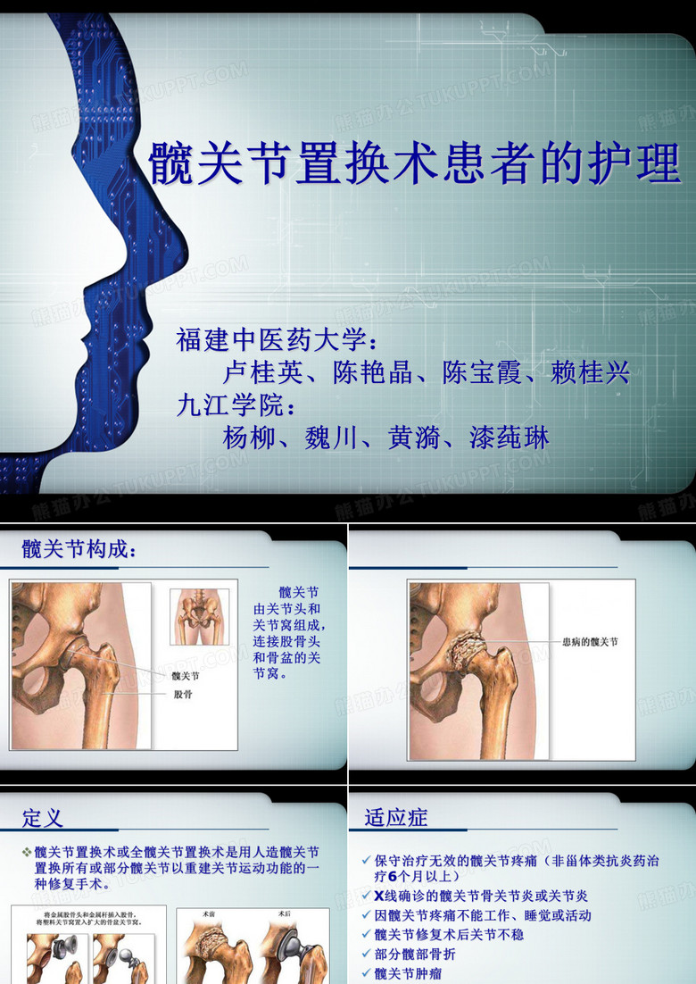 髋关节置换