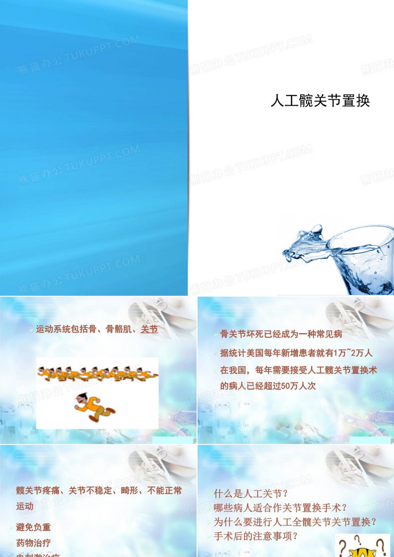 人工髋关节置换