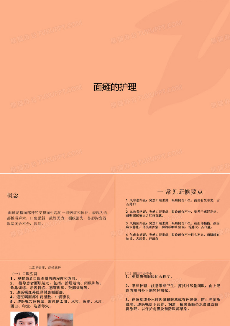 面瘫的护理