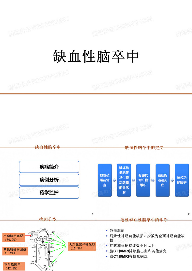 病例分析：缺血性脑卒中