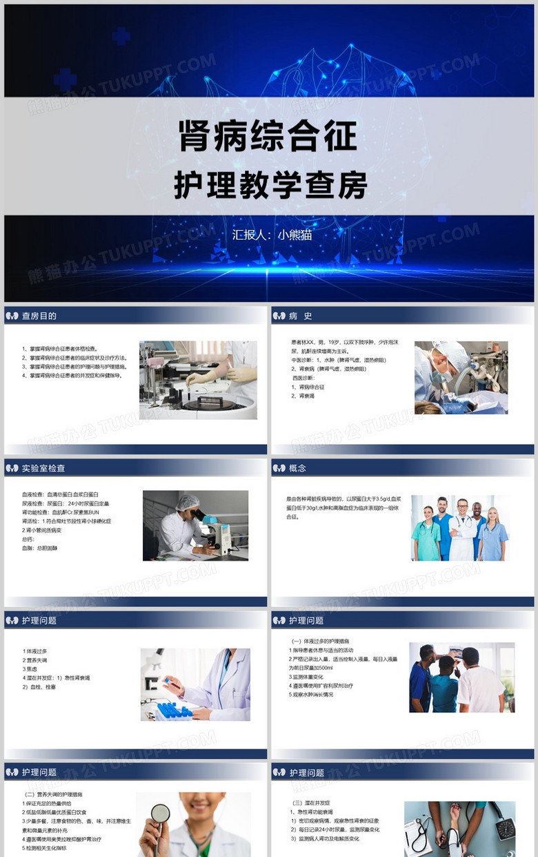 肾病综合征护理教学查房PPT模板