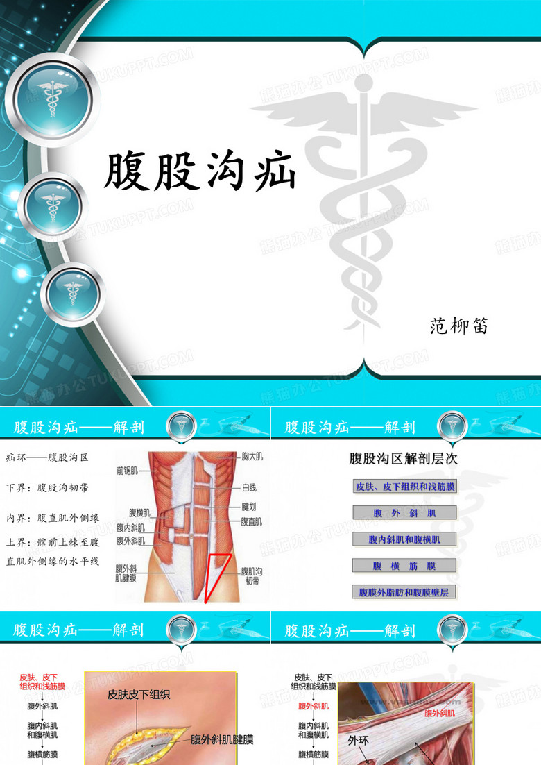 腹股沟疝
