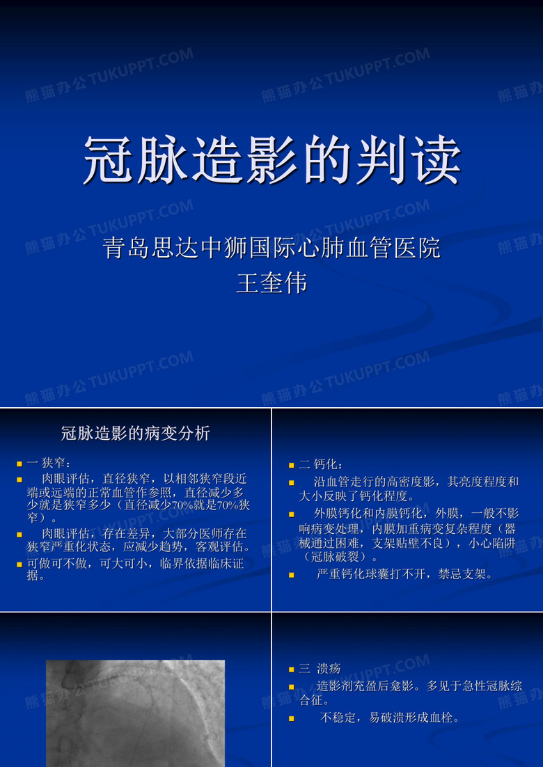 冠脉造影的判读