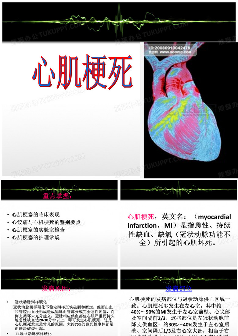 心肌梗塞PPT