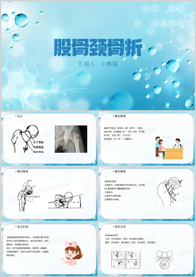 股骨颈骨折护理查房股骨颈骨折PPT模板