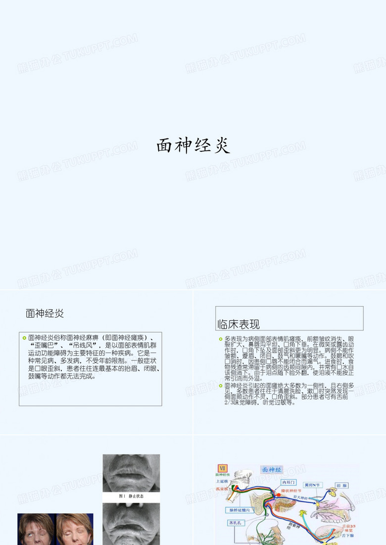 面神经炎 PPT