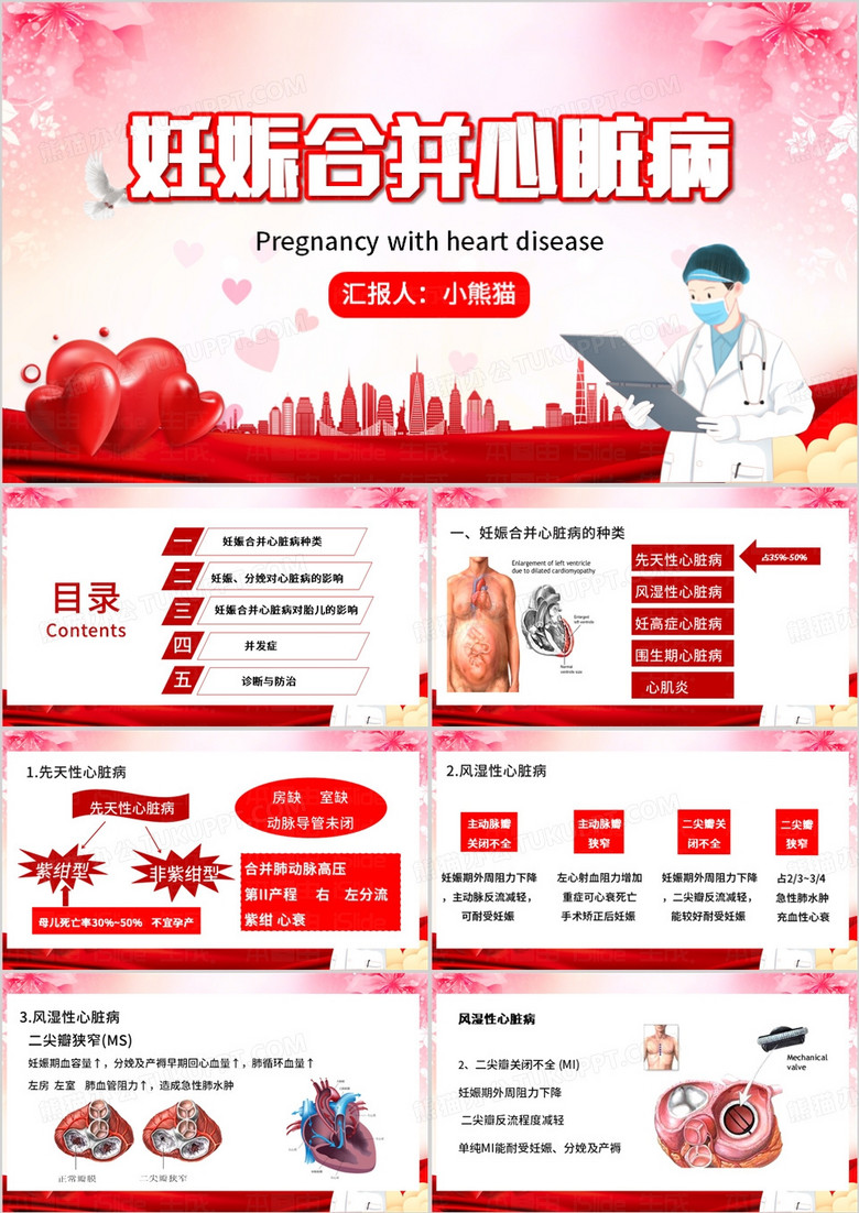 红色简约风妊娠合并心脏病PPT模板