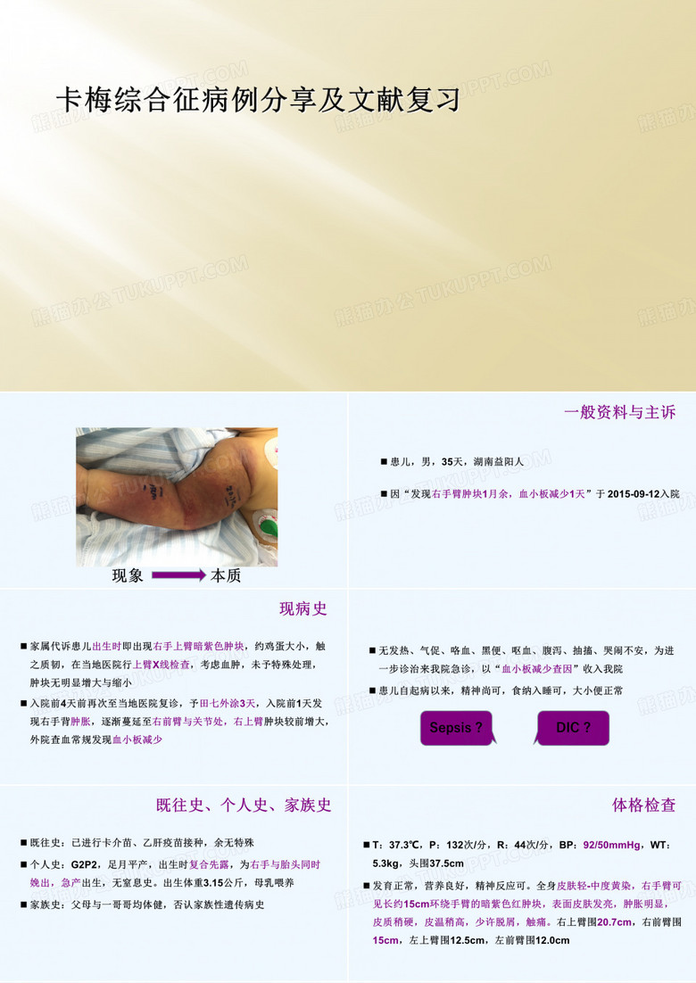 卡梅综合征病例分享及文献复习