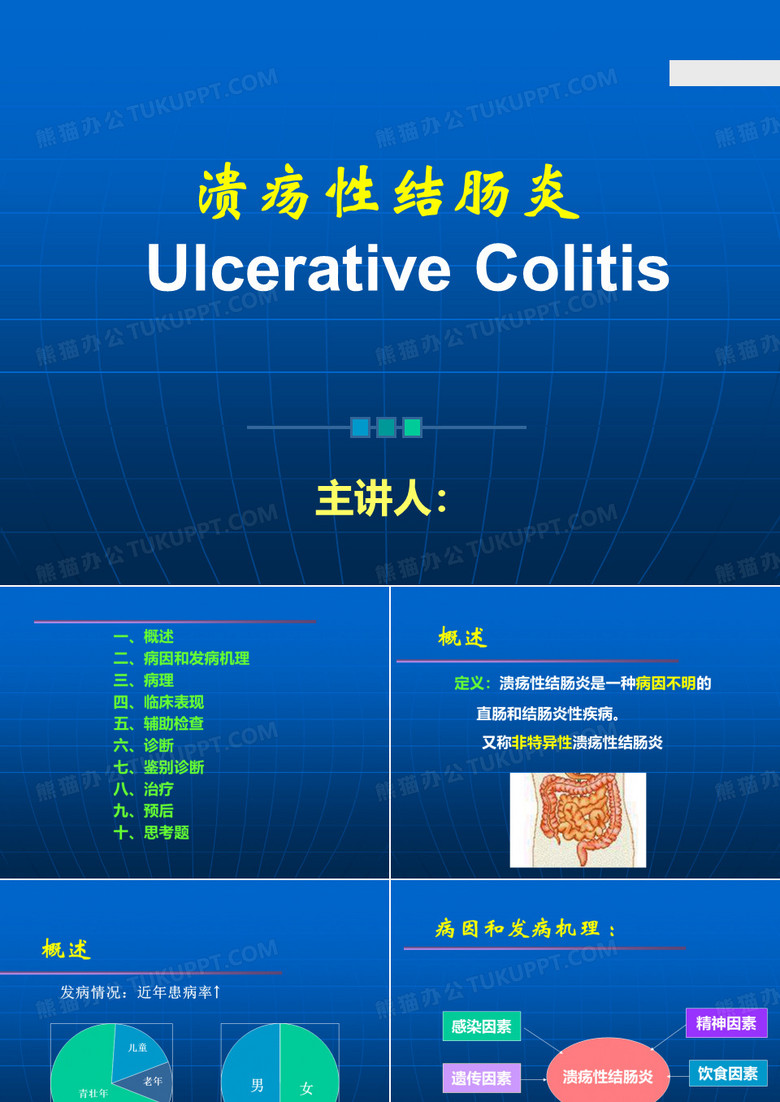 溃疡性结肠炎