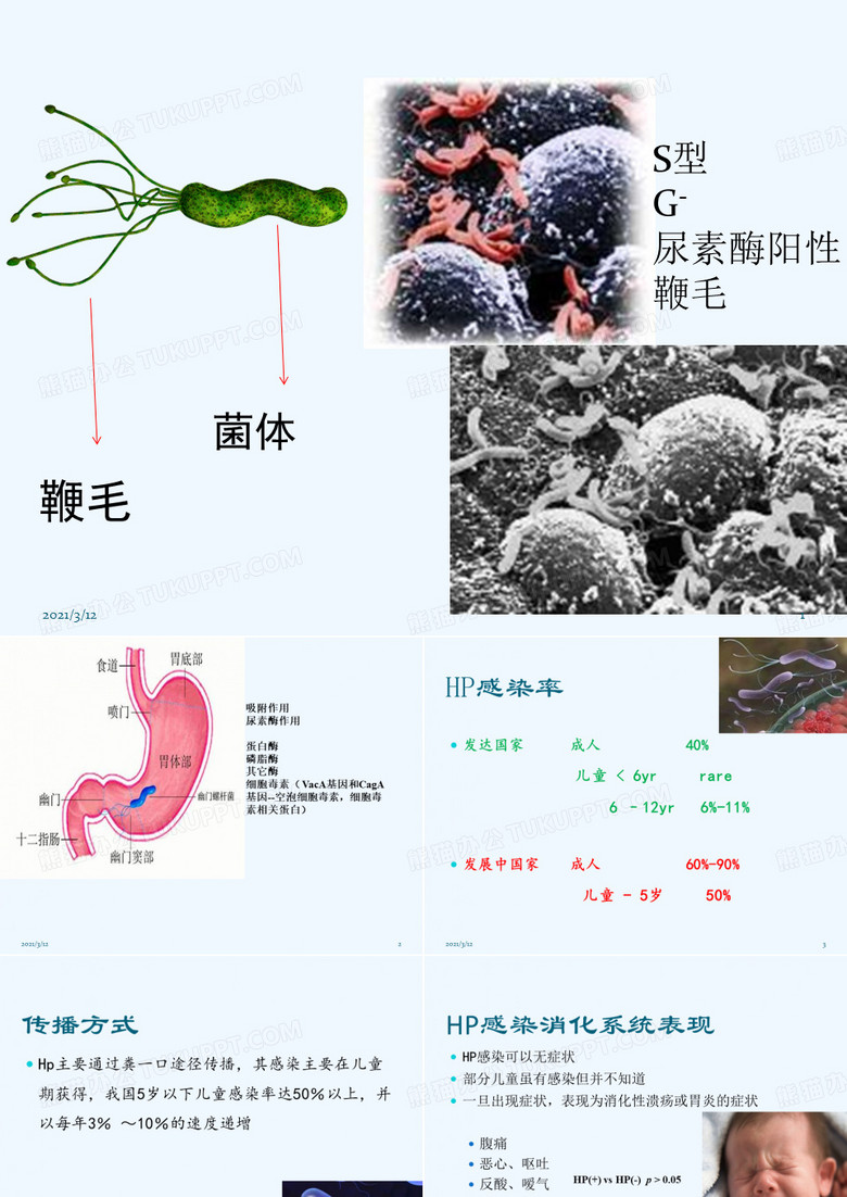 幽门螺杆菌感染