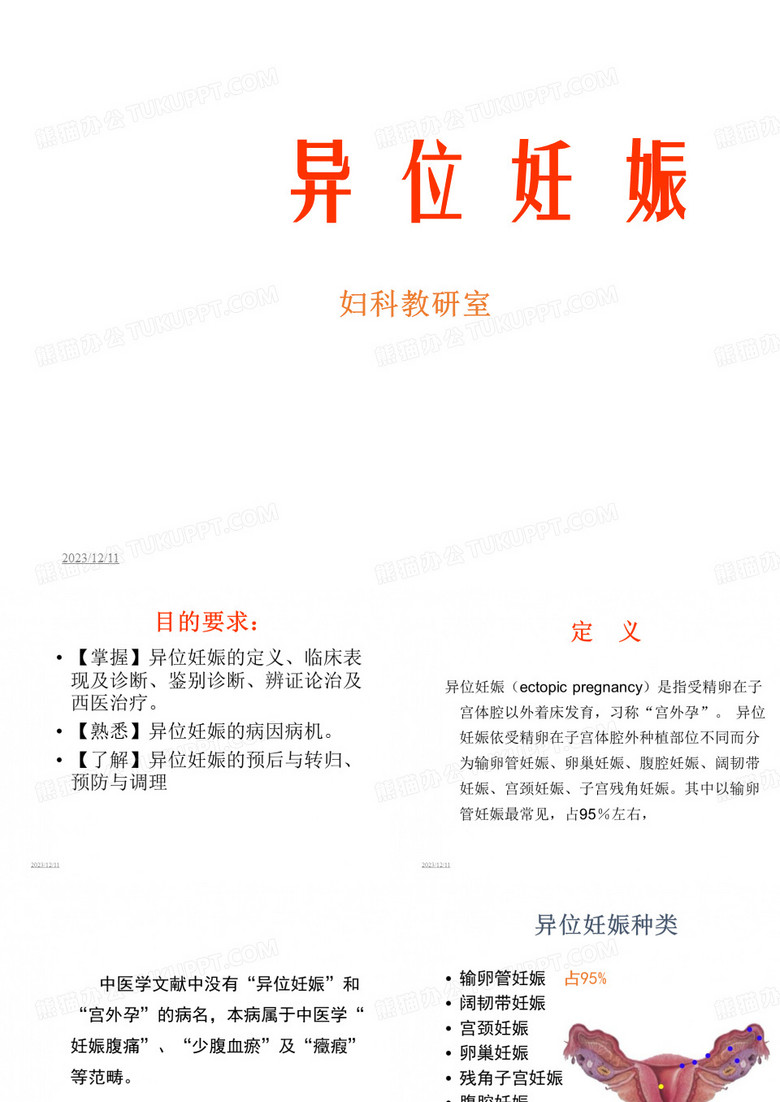 _异位妊娠