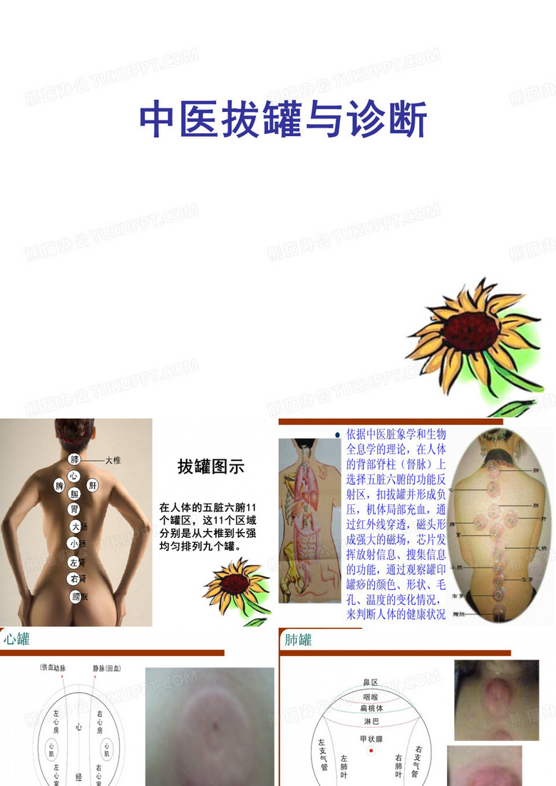 中医拔罐与诊断