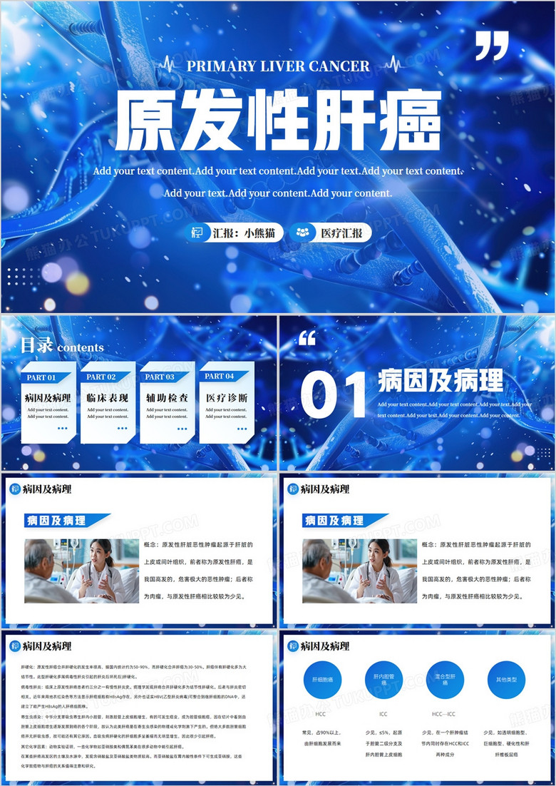 蓝色医疗原发性肝癌病例PPT模板