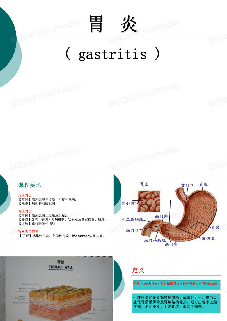 胃炎