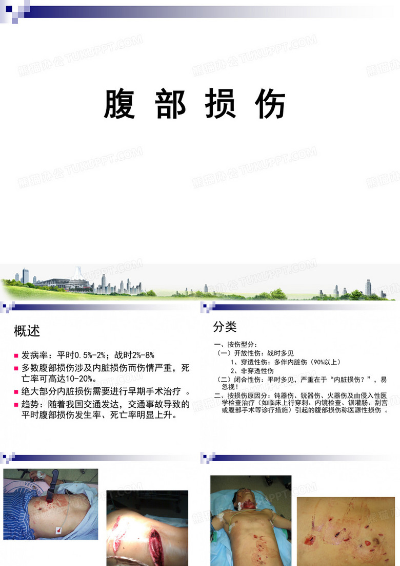 腹部损伤
