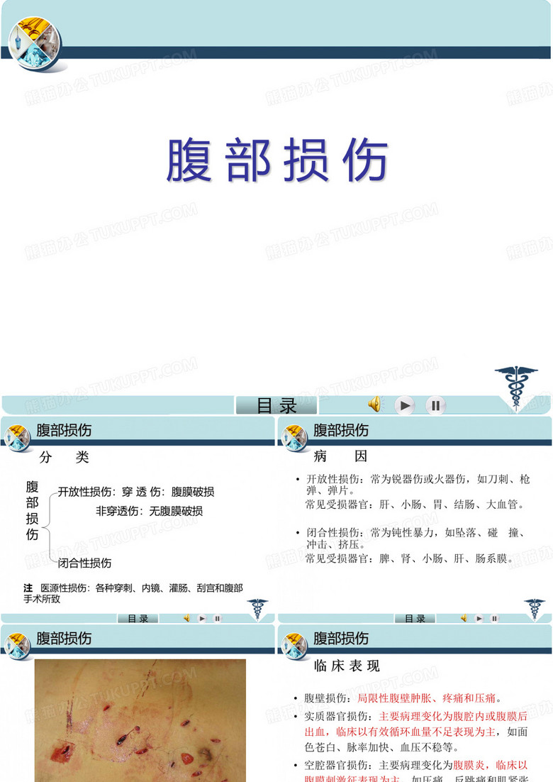 腹部损伤课件