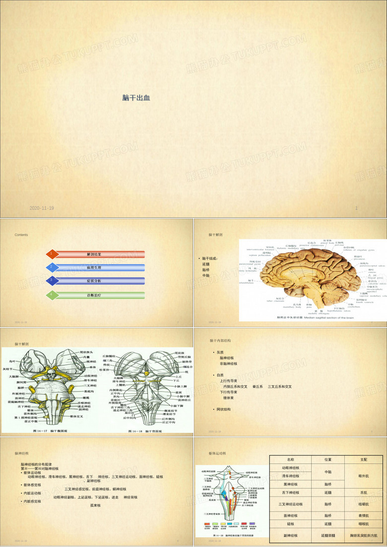 脑干出血(最新课件)