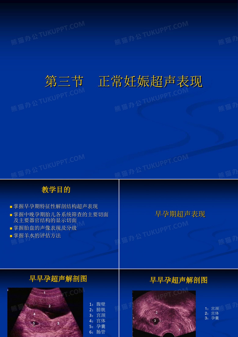 正常妊娠超声表现-55页PPT资料55页PPT
